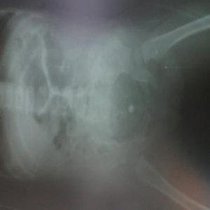 X-ray - Foreign body in rectum